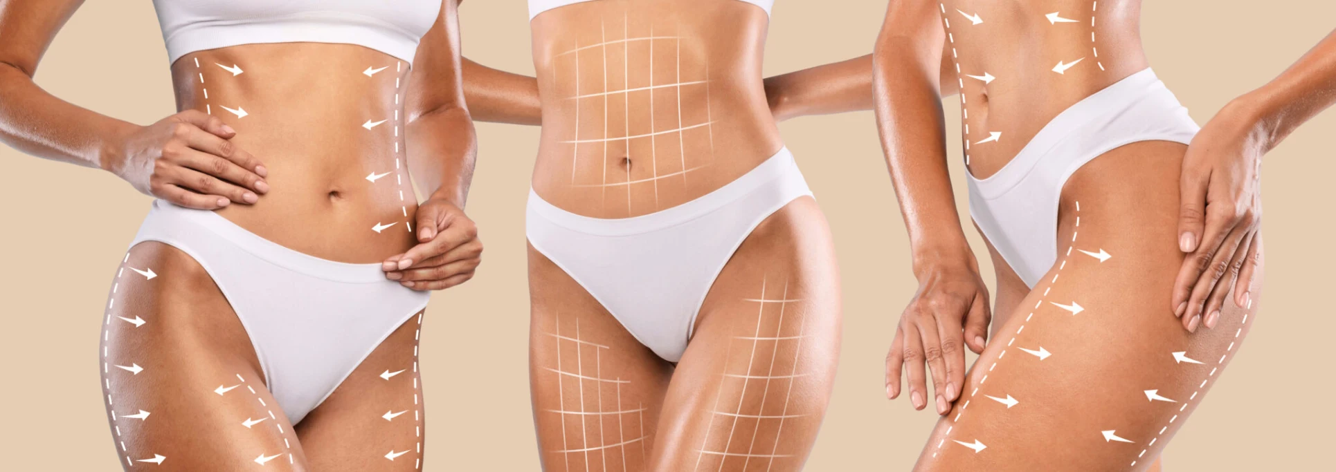 Lymphatic body sculpting therapy in Newport Beach